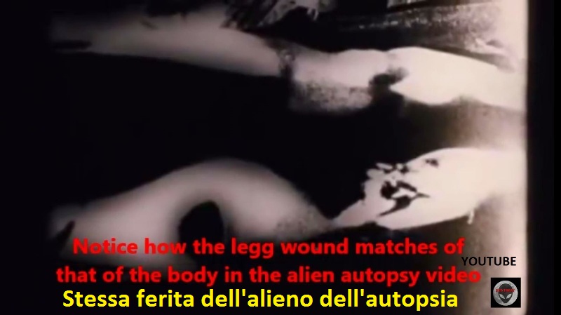 6-la-ferita-sulla-gamba-e-identica-a-quella-del-famoso-filmato-dellautopsia